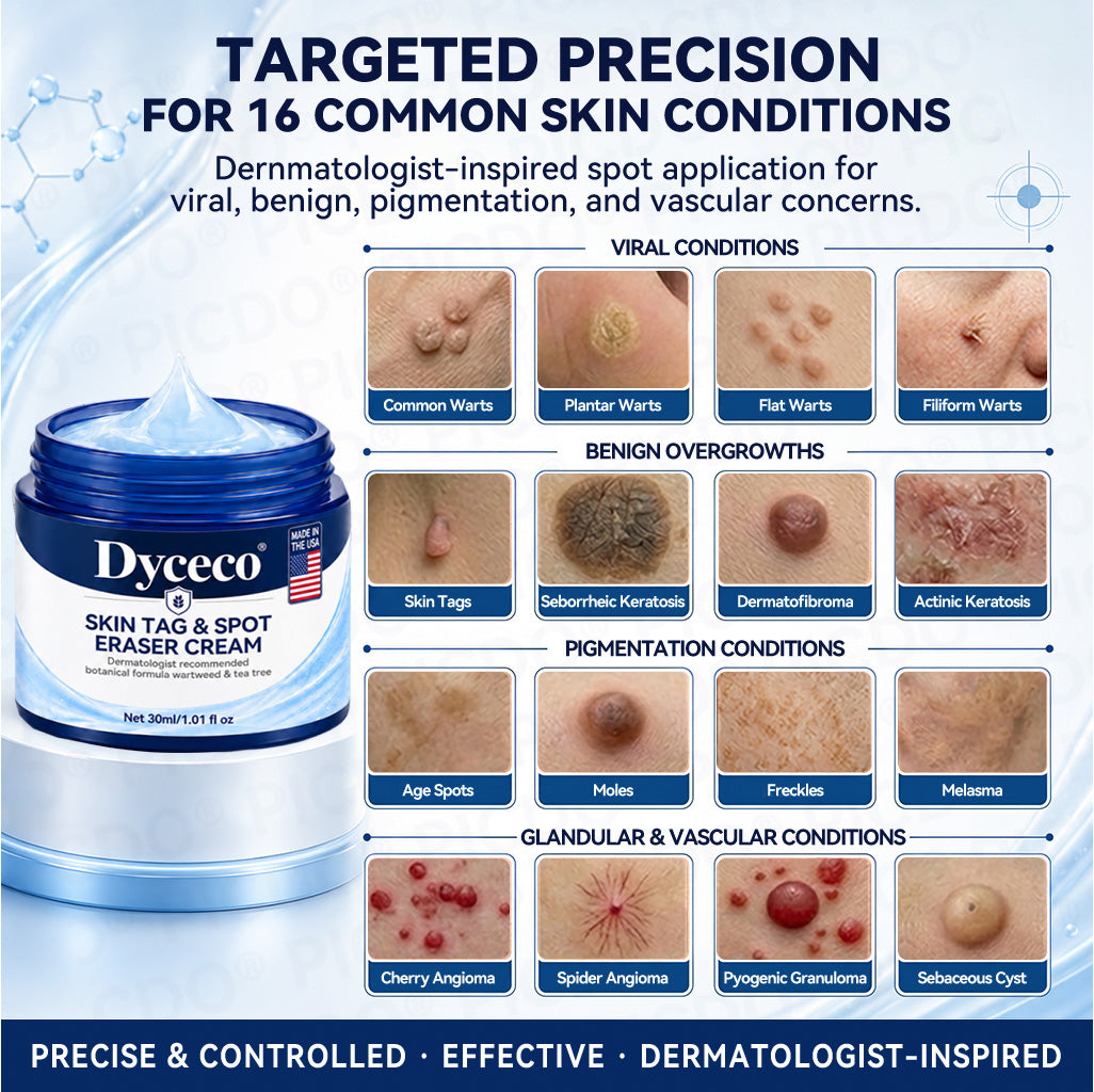 Dyceco® 🥝7-𝐃𝐚𝐲 𝐒𝐤𝐢𝐧 𝐓𝐚𝐠 & 𝐒𝐩𝐨𝐭 𝐄𝐫𝐚𝐬𝐞𝐫 𝐂𝐫𝐞𝐚𝐦 (Zero Pain, Zero 𝐒𝐜𝐚𝐫𝐬 Formula)