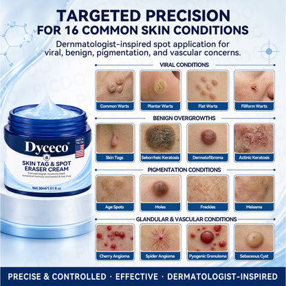 Dyceco® 🥝7-𝐃𝐚𝐲 𝐒𝐤𝐢𝐧 𝐓𝐚𝐠 & 𝐒𝐩𝐨𝐭 𝐄𝐫𝐚𝐬𝐞𝐫 𝐂𝐫𝐞𝐚𝐦 (Zero Pain, Zero 𝐒𝐜𝐚𝐫𝐬 Formula)