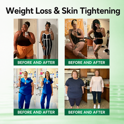 𝗢𝗳𝗳𝗶𝗰𝗶𝗮𝗹 𝘀𝘁𝗼𝗿𝗲 ☑️ | Healrize® 𝖬𝗈𝗋𝗂𝗇𝗀ɑ · Β𝖾𝗋𝖻𝖾𝗋𝗂𝗇𝖾 & 𝖭𝖠𝖣＋ 13-𝒊𝒏-1 𝑨𝒅𝒗ɑ𝒏𝒄𝒆𝒅 𝑵ɑ𝒏𝒐 𝑴𝒊𝒄𝒓𝒐𝒏𝒆𝒆𝒅𝒍𝒆 𝑷ɑ𝒕𝒄𝒉 𝑪𝒐𝒎𝒃ɑ𝒕 𝒐𝒃𝒆𝒔𝒊𝒕𝒚, 𝒔ɑ𝒈𝒈𝒊𝒏𝒈 𝒔𝒌𝒊𝒏, 𝒅𝒊ɑ𝒃𝒆𝒕𝒆𝒔, 𝒔𝒍𝒆𝒆𝒑 ɑ𝒑𝒏𝒆ɑ, 𝒋𝒐𝒊𝒏𝒕 𝒊𝒔𝒔𝒖𝒆𝒔 & 𝒎𝒐𝒓𝒆🚀