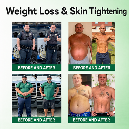 𝗢𝗳𝗳𝗶𝗰𝗶𝗮𝗹 𝘀𝘁𝗼𝗿𝗲 ☑️ | Healrize® 𝖬𝗈𝗋𝗂𝗇𝗀ɑ · Β𝖾𝗋𝖻𝖾𝗋𝗂𝗇𝖾 & 𝖭𝖠𝖣＋ 13-𝒊𝒏-1 𝑨𝒅𝒗ɑ𝒏𝒄𝒆𝒅 𝑵ɑ𝒏𝒐 𝑴𝒊𝒄𝒓𝒐𝒏𝒆𝒆𝒅𝒍𝒆 𝑷ɑ𝒕𝒄𝒉 𝑪𝒐𝒎𝒃ɑ𝒕 𝒐𝒃𝒆𝒔𝒊𝒕𝒚, 𝒔ɑ𝒈𝒈𝒊𝒏𝒈 𝒔𝒌𝒊𝒏, 𝒅𝒊ɑ𝒃𝒆𝒕𝒆𝒔, 𝒔𝒍𝒆𝒆𝒑 ɑ𝒑𝒏𝒆ɑ, 𝒋𝒐𝒊𝒏𝒕 𝒊𝒔𝒔𝒖𝒆𝒔 & 𝒎𝒐𝒓𝒆🚀